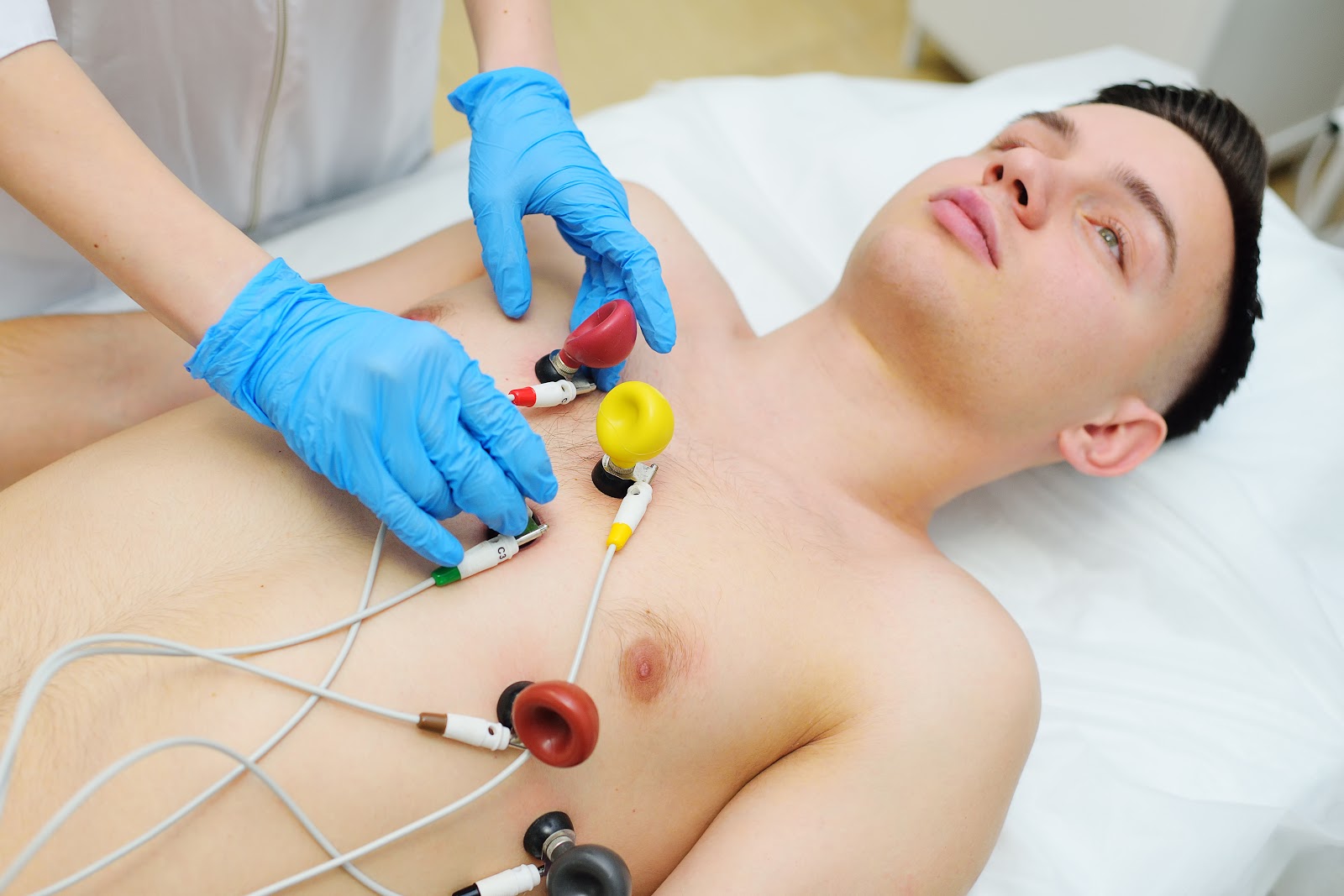 Eletrocardiograma (ECG)