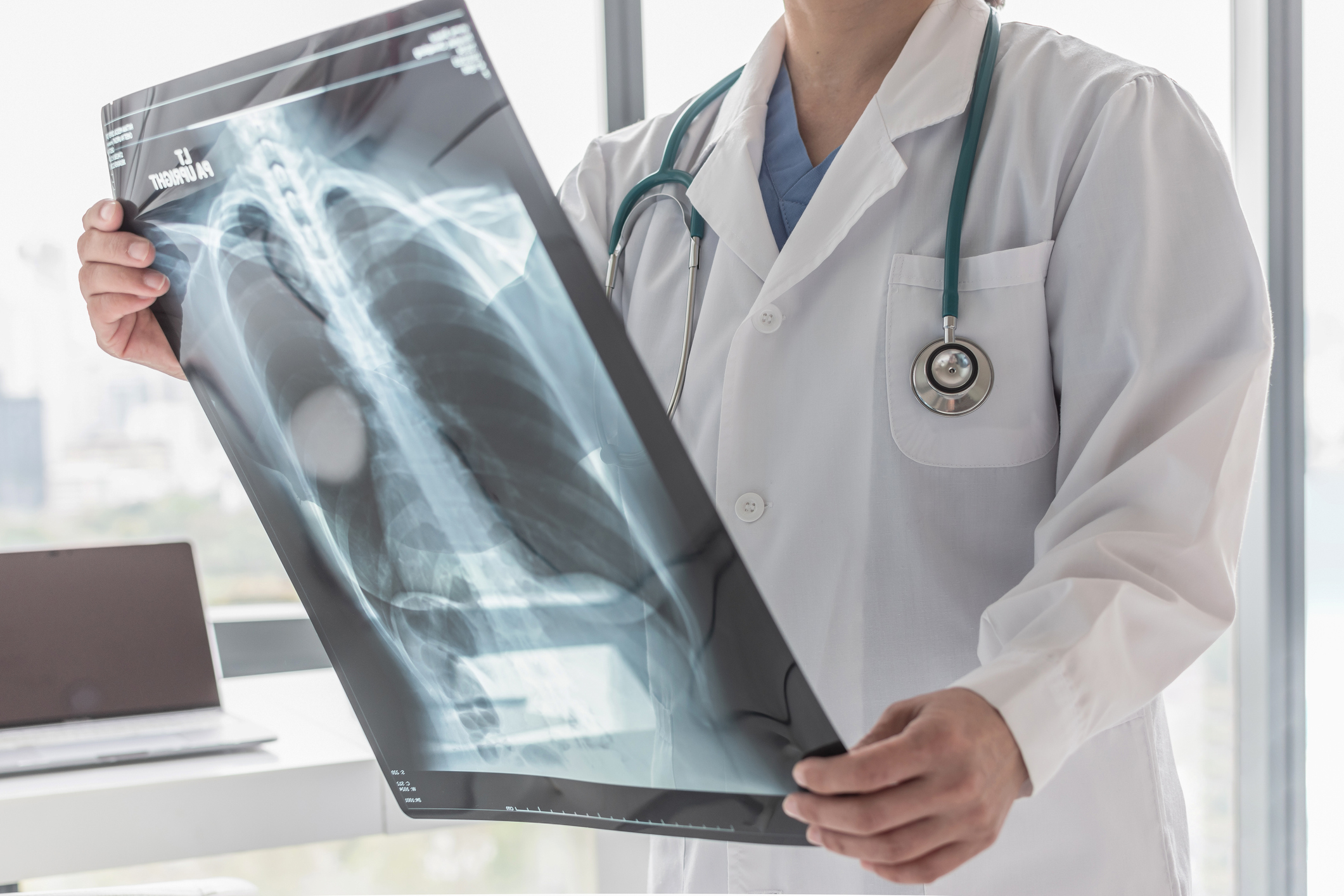 Radiografia (Raio-X)